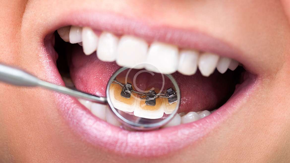 Protetică dentară