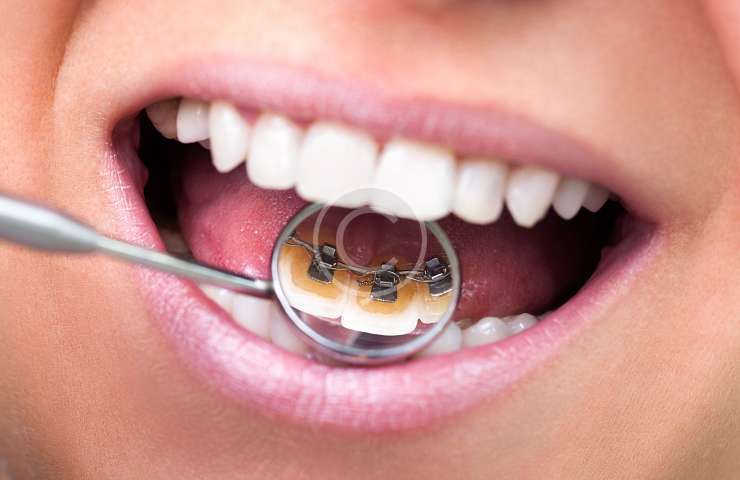 Protetică dentară
